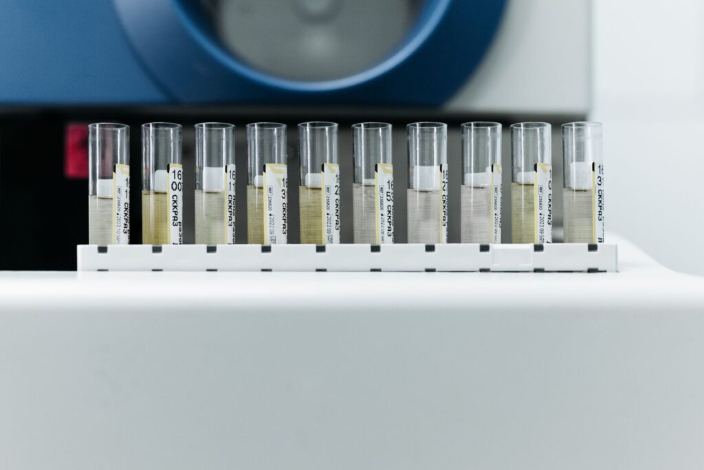 Oznakowane probówki ustawione w stojaku w nowoczesnym laboratorium